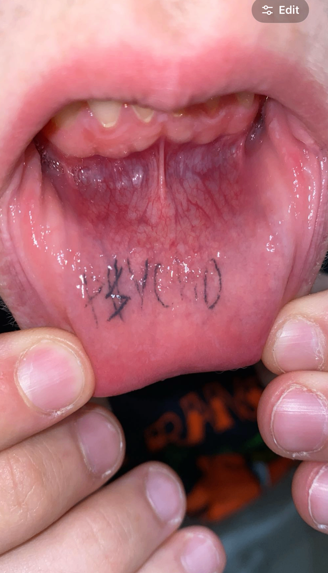 Lip tattoo forensic capture